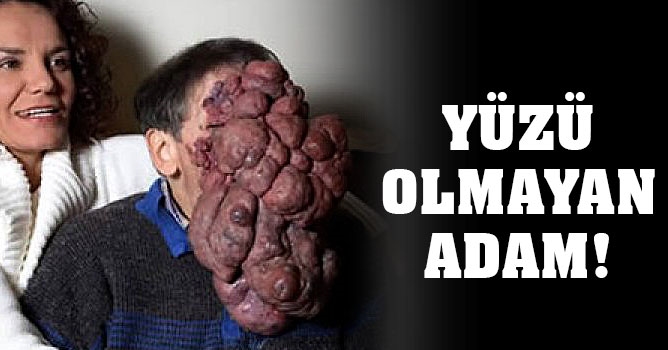 Yüzü Olmayan Adam
