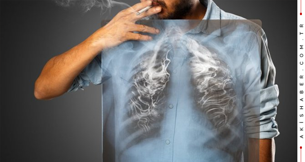Sigara Akciğer Kanseri için En Büyük Risk