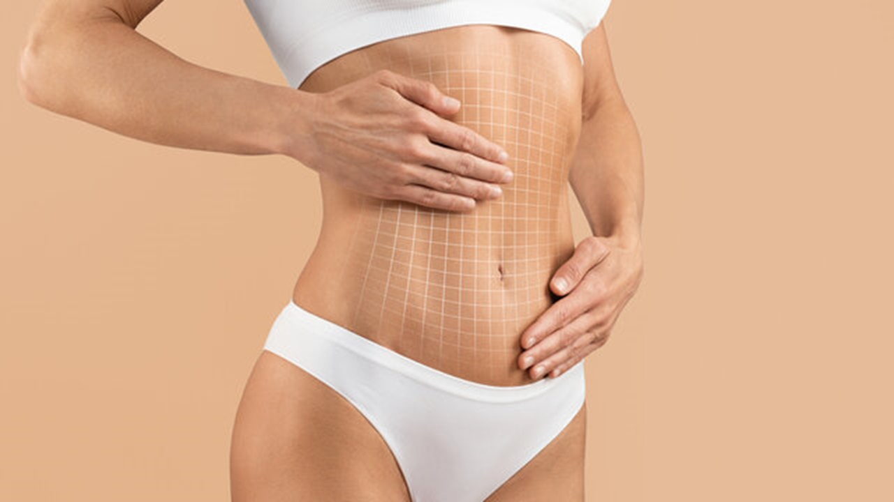 Liposuction Ameliyatı Nasıl Yapılır? Aşamaları ve Süreç