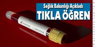 Koronavirüs Test Sonuçları Bu Linkte...