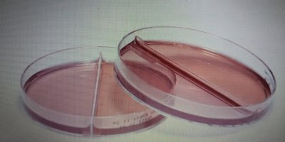 Macconkey Agar ile Mikrobiyolojik Analizlerde Güvenilir Sonuçlar