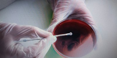 Macconkey Agar ile Mikrobiyolojik Analizlerde Güvenilir Sonuçlar